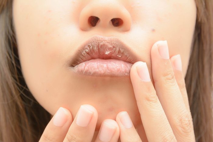 dry Mouth women
