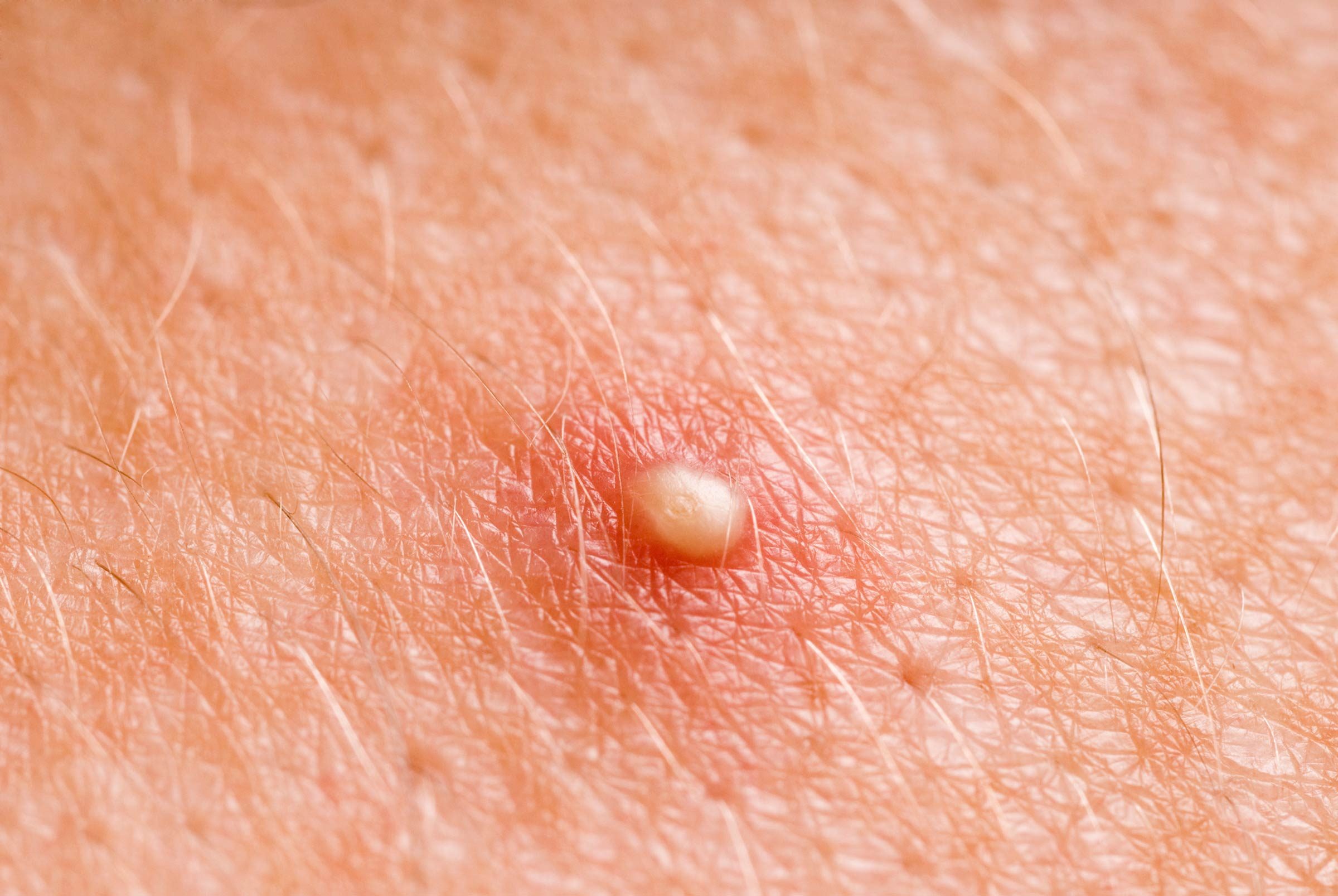 015_Unexpected_ways_toothpaste