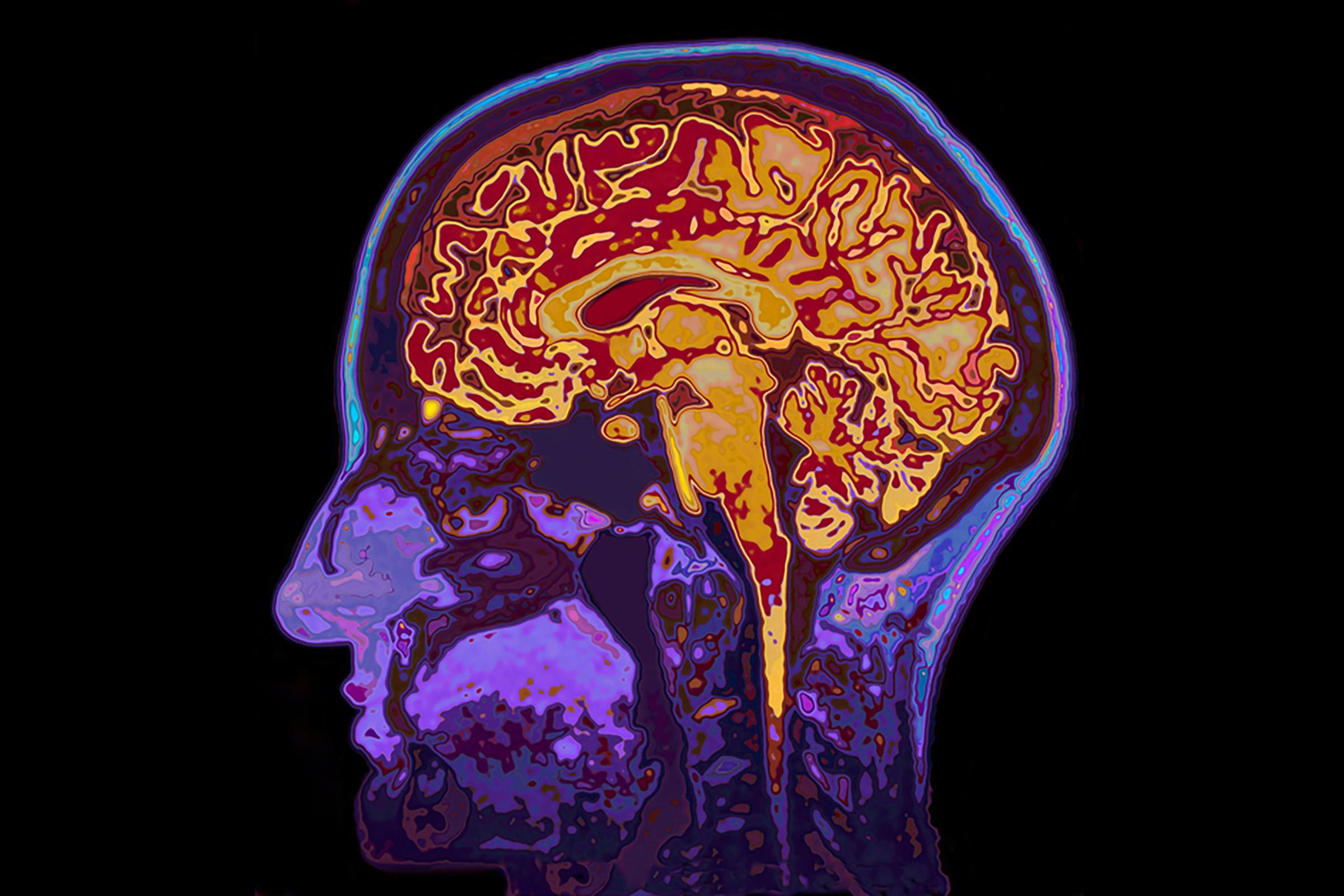 5 People Whose Brain Injuries Gave Them New Abilities