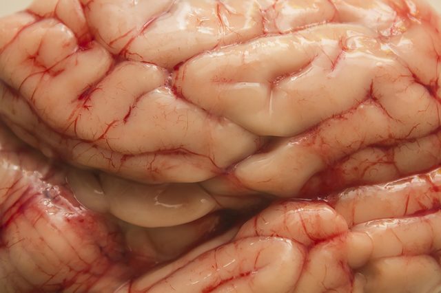 Brain