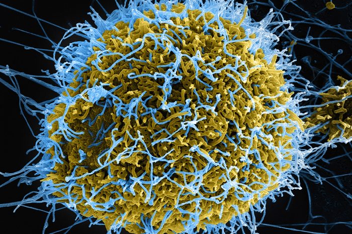 ebola virus