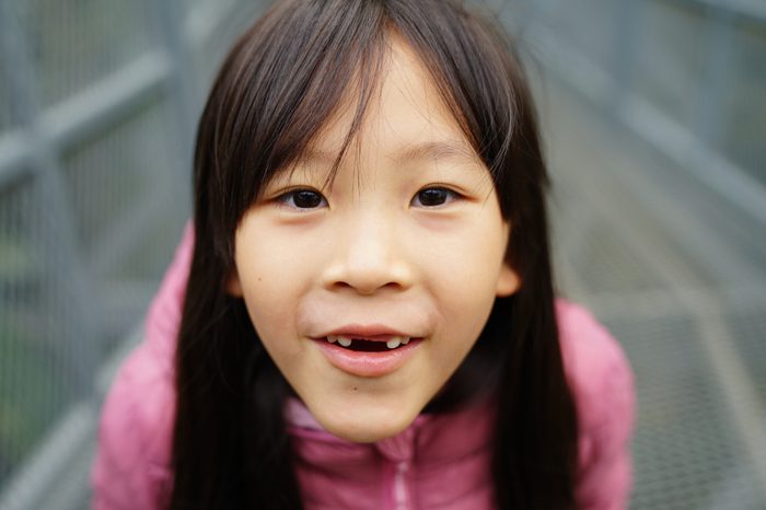 Girl smile with broken tooth