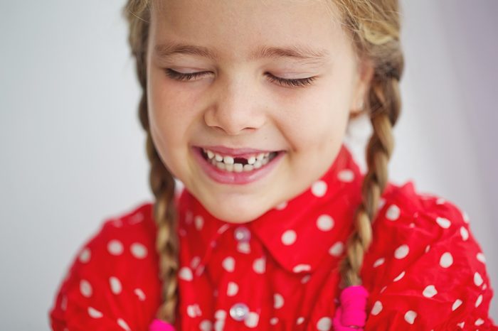 Portrait of preschooler girl with open mouth without milk tooth