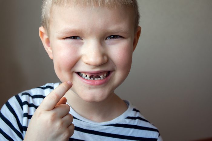 Young boy smiling, showing off his first missing milk tooth (teeth), close up portrait. Childhood healthcare, healthy changing teeth concept.