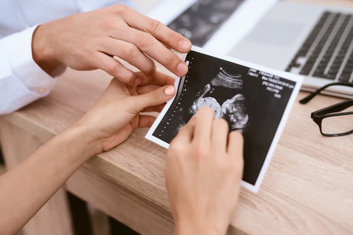 Doctor showing a pregnant girl picture ultrasound. She came to the doctor in the clinic. It's a gynecologist. He is dressed in a white robe.