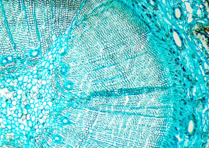 Pine mature wood cross section. Light microscope slide with microsection of an evergreen conifer in the genus Pinus. Plant anatomy. Biology. Photo.