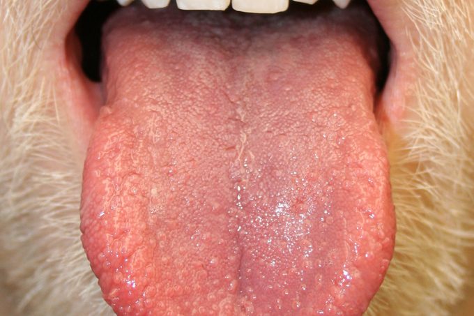Person with tongue bumps