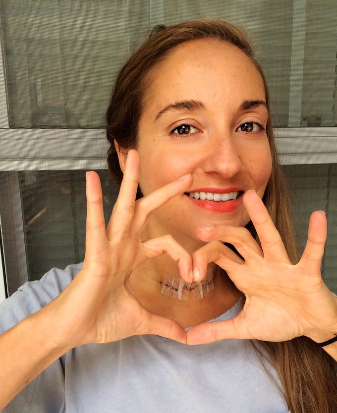 Christine coppa scar