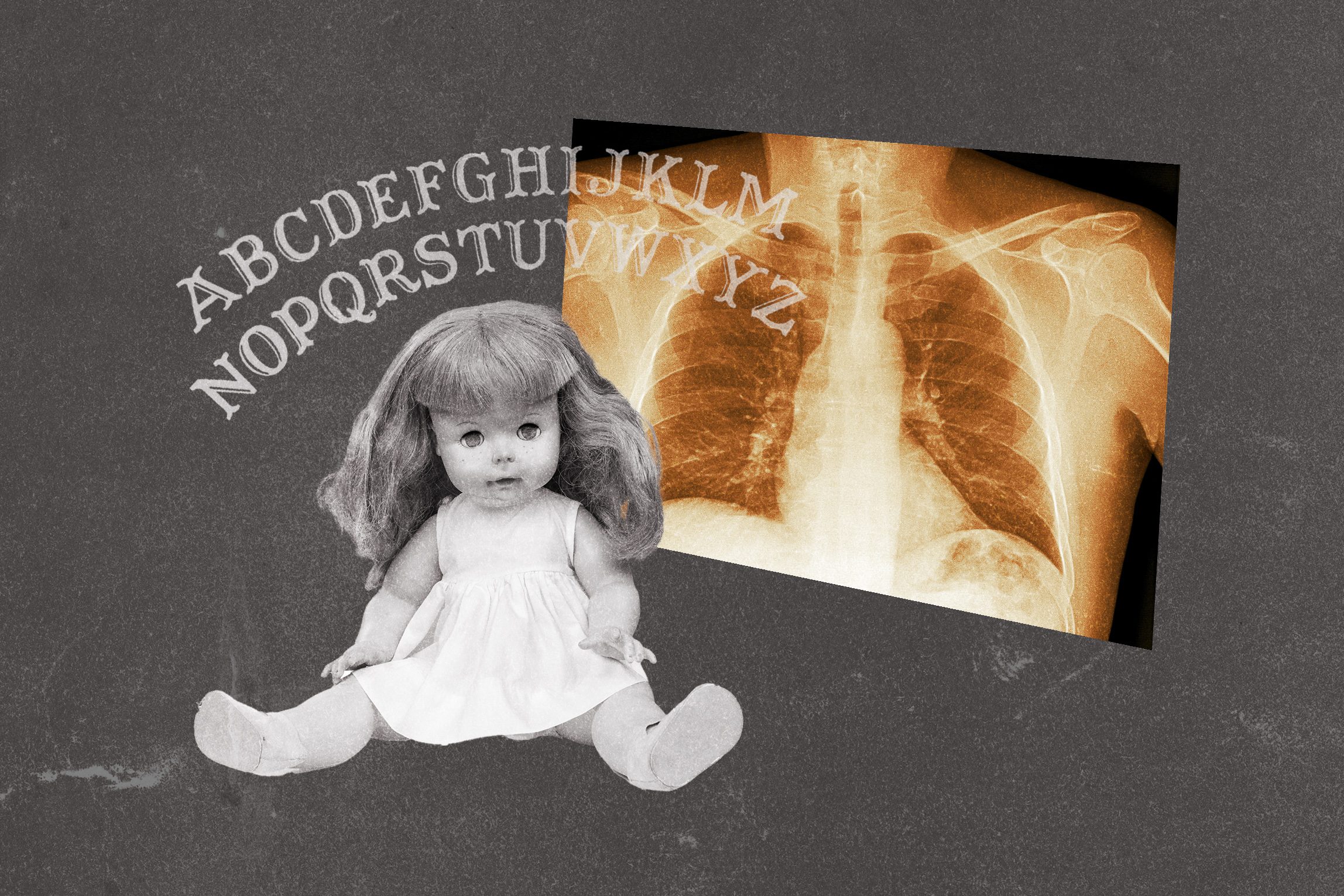 A doll sits on a gray background with an X-ray image of a chest nearby; the alphabet arches above.