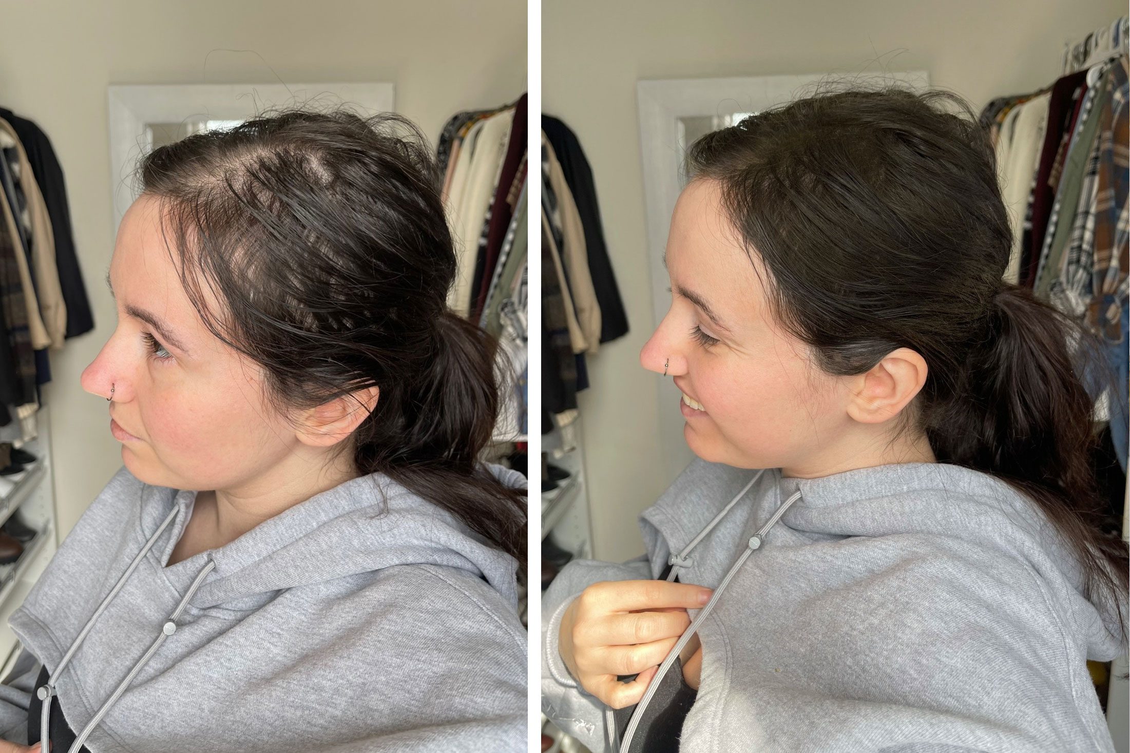 toppik fibers before and after